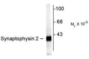 Image no. 1 for anti-Synaptoporin (SYNPR) (C-Term) antibody (ABIN372722) (Synaptoporin Antikörper  (C-Term))