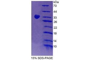 SDS-PAGE (SDS) image for Signal-Regulatory Protein gamma (SIRPG) (AA 111-372) protein (His tag) (ABIN2126759)