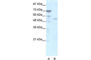 WB Suggested Anti-EVX2 Antibody Titration:  2. (EVX2 Antikörper  (N-Term))