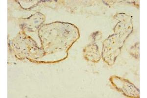 Immunohistochemistry of paraffin-embedded human placenta tissue using ABIN7156525 at dilution of 1:100 (ITIH5 Antikörper  (AA 35-161))