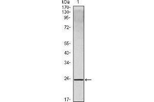 Western blot analysis using IL10 mouse mAb against IL10 recombinant protein. (IL-10 Antikörper)