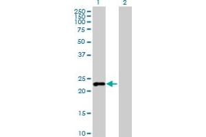 Western Blot analysis of C7orf16 expression in transfected 293T cell line by C7orf16 MaxPab polyclonal antibody.