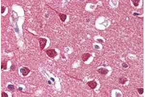 Human Brain, Cortex (formalin-fixed, paraffin-embedded) stained with REXO1 antibody ABIN364336 at 5 ug/ml followed by biotinylated anti-mouse IgG secondary antibody ABIN481714, alkaline phosphatase-streptavidin and chromogen. (REXO1 Antikörper  (AA 1060-1221))