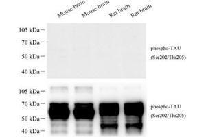 Western blot analysis of phospho-TAU (S202/T205) (ABIN7075838) at dilution of 1: 1000 The figure above was treated with phospho-blocking pepide, the figure below was treated with non-phospho- blocking pepide. (tau Antikörper  (pSer202, pThr205))