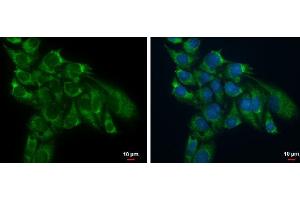 ICC/IF Image TSFM antibody detects TSFM protein at mitochondria by immunofluorescent analysis. (TSFM Antikörper)