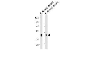 Western Blotting (WB) image for anti-Wingless-Type MMTV Integration Site Family, Member 10B (WNT10B) (AA 193-222) antibody (ABIN390524)