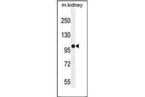 Western blot analysis of KIAA1324L Antibody (N-term) in mouse kidney tissue lysates (35ug/lane). (KIAA1324-Like Antikörper  (N-Term))