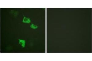 Immunofluorescence analysis of HuvEc cells, using eEF2 (Ab-56) Antibody. (EEF2 Antikörper  (AA 31-80))