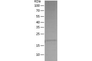 Caspase 9 Protein (AA 1-159) (His tag)