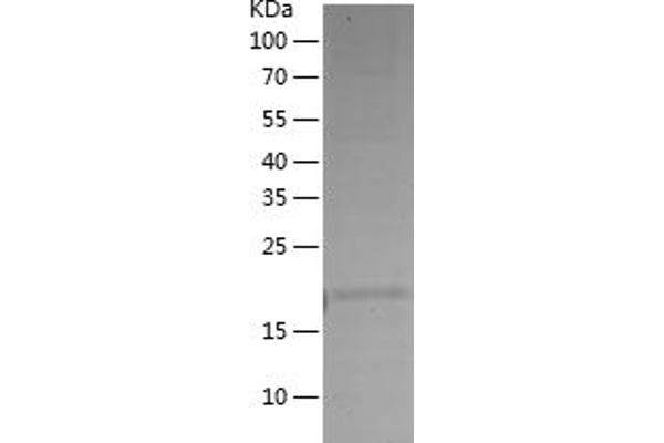 Caspase 9 Protein (AA 1-159) (His tag)