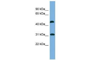 CTDSP2 antibody used at 1 ug/ml to detect target protein. (CTDSP2 Antikörper)
