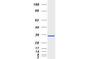Validation with Western Blot (MGLL Protein (Transcript Variant 1) (Myc-DYKDDDDK Tag))
