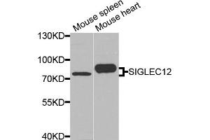 Western blot analysis of extracts of various cell lines, using SIGLEC12 antibody. (SIGLEC12 Antikörper)