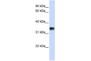 KCTD7 antibody used at 1 ug/ml to detect target protein. (KCTD7 Antikörper  (N-Term))