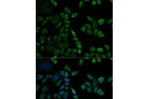 Immunofluorescence analysis of U2OS cells using MSLN Polyclonal Antibody (Mesothelin Antikörper)