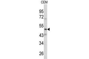 Western blot analysis of SMYD3 antibody (N-term) in CEM cell line lysates (35ug/lane).