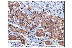 IHC analysis of CDC42 using anti-CDC42 antibody (ABIN6719528).