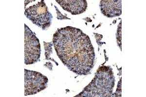 IHC analysis of TTLL2 using anti-TTLL2 antibody (ABIN7600850).