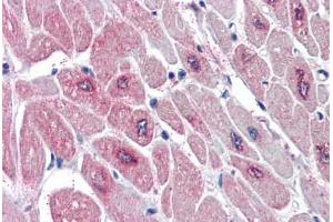 Human Heart (formalin-fixed, paraffin-embedded) stained with PARD6A antibody ABIN337017 at 5 ug/ml followed by biotinylated anti-goat IgG secondary antibody ABIN481715, alkaline phosphatase-streptavidin and chromogen. (PARD6A Antikörper  (AA 334-346))