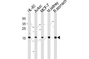 NME2 Antibody (F40) (ABIN392656 and ABIN2842157) western blot analysis in HL-60,Jurkat,MCF-7 cell line,mouse kidney and rat stomach tissue lysates (35 μg/lane). (NME2 Antikörper  (N-Term))