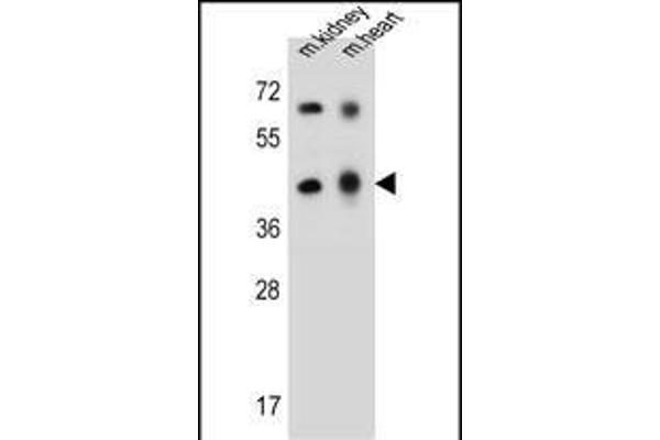 ADAL anticorps  (C-Term)