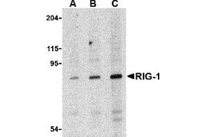 Western Blotting (WB) image for anti-DEAD (Asp-Glu-Ala-Asp) Box Polypeptide 58 (DDX58) antibody (ABIN1031791)
