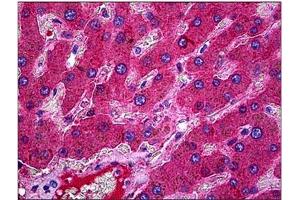 Human Liver: Formalin-Fixed, Paraffin-Embedded (FFPE). (C3 Antikörper)