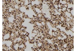 ABIN6277586 at 1/100 staining Rat lung tissue by IHC-P.
