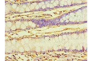 Immunohistochemistry of paraffin-embedded human colon tissue using ABIN7166903 at dilution of 1:100