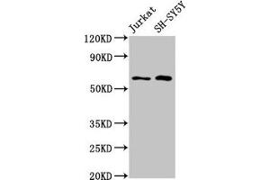 Western Blot Positive WB detected in: Jurkat whole cell lysate, SH-SY5Y whole cell lysate All lanes: BORA antibody at 4. (BORA Antikörper  (AA 178-312))