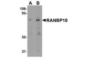 Western blot analysis of RANBP10 (arrow) in human skeletal muscle tissue lysate with RANBP10 Antibody at (A) 1 and (B) 2 μg/ml. (RANBP10 Antikörper  (Center))