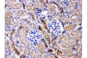 Immunohistochemistry (IHC) image for anti-Guanine Nucleotide Binding Protein (G Protein), beta Polypeptide 1 (GNB1) (AA 2-42), (N-Term) antibody (ABIN4886607)