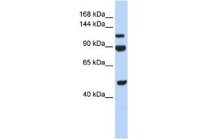 WB Suggested Anti-NARG1L Antibody Titration:  0. (NARG1L Antikörper  (Middle Region))