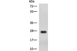 Western blot analysis of MCF7 cell lysate using DHRS2 Polyclonal Antibody at dilution of 1:750 (DHRS2 Antikörper)