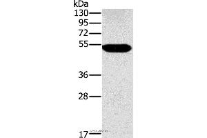 Western blot analysis of Human placenta tissue, using FUCA1 Polyclonal Antibody at dilution of 1:500 (FUCA1 Antikörper)