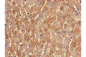 Immunohistochemistry of paraffin-embedded human liver tissue using ABIN7163820 at dilution of 1:100 (PKD1L1 Antikörper  (AA 921-1164))