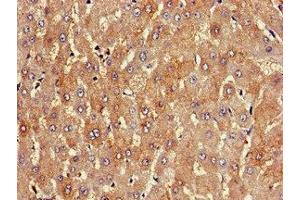 Immunohistochemistry of paraffin-embedded human liver tissue using ABIN7163820 at dilution of 1:100