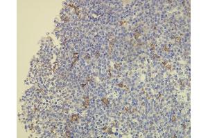 Immunohistochemistry (IHC) image for anti-CD163 (CD163) (AA 134-148), (N-Term) antibody (ABIN870404) (CD163 Antikörper  (N-Term))