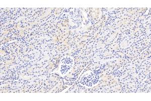 Detection of F2 in Rat Kidney Tissue using Polyclonal Antibody to Coagulation Factor II (F2) (Prothrombin Antikörper  (AA 201-323))