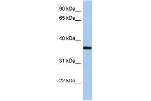 WB Suggested Anti-LDLRAP1 Antibody Titration: 0. (LDLRAP1 Antikörper  (N-Term))