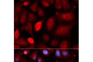 Immunofluorescence analysis of U2OS cells using PDLIM5 Polyclonal Antibody (PDLIM5 Antikörper)