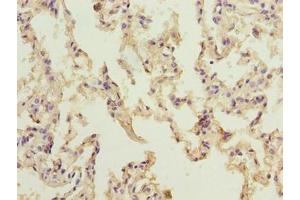 Immunohistochemistry of paraffin-embedded human lung tissue using ABIN7161614 at dilution of 1:100 (NINJ2 Antikörper  (AA 17-81))
