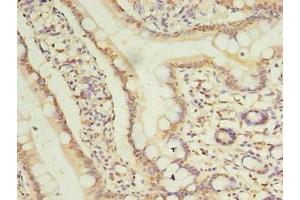 Immunohistochemistry of paraffin-embedded human small intestine tissue using ABIN7173421 at dilution of 1:100 (TRIM15 Antikörper  (AA 122-387))