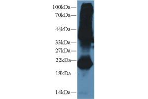 Western blot analysis of Mouse Testis lysate, using Mouse GREM1 Antibody (2 µg/ml) and HRP-conjugated Goat Anti-Rabbit antibody ( (GREM1 Antikörper  (AA 25-184))