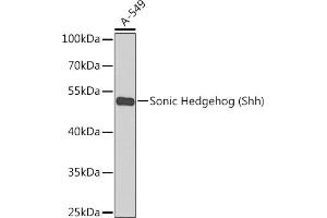 Western blot analysis of extracts of A-549 cells, using Sonic Hedgehog (Sonic Hedgehog (Shh)) antibody  at 1:1000 dilution. (Sonic Hedgehog Antikörper)