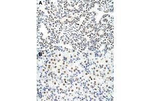 Immunohistochemical staining (Formalin-fixed paraffin-embedded sections) of human lung (A) and human liver (B) with HNRNPA3 polyclonal antibody  at 4-8 ug/mL working concentration. (HNRNPA3 Antikörper  (N-Term))
