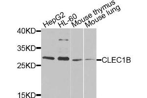Western blot analysis of extracts of various cells, using CLEC1B antibody. (C-Type Lectin Domain Family 1, Member B (CLEC1B) Antikörper)