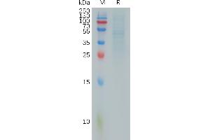 SDS-PAGE (SDS) image for Ras Homolog Gene Family, Member C (RHOC) (AA 1-190) protein (Fc Tag) (ABIN6964315)