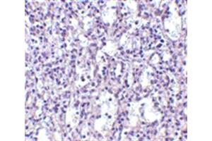 Image no. 2 for anti-TBC1 Domain Family, Member 10C (TBC1D10C) (N-Term) antibody (ABIN318913) (Carabin Antikörper  (N-Term))