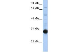WB Suggested Anti-NR0B2 Antibody Titration:  0. (NR0B2 Antikörper  (Middle Region))